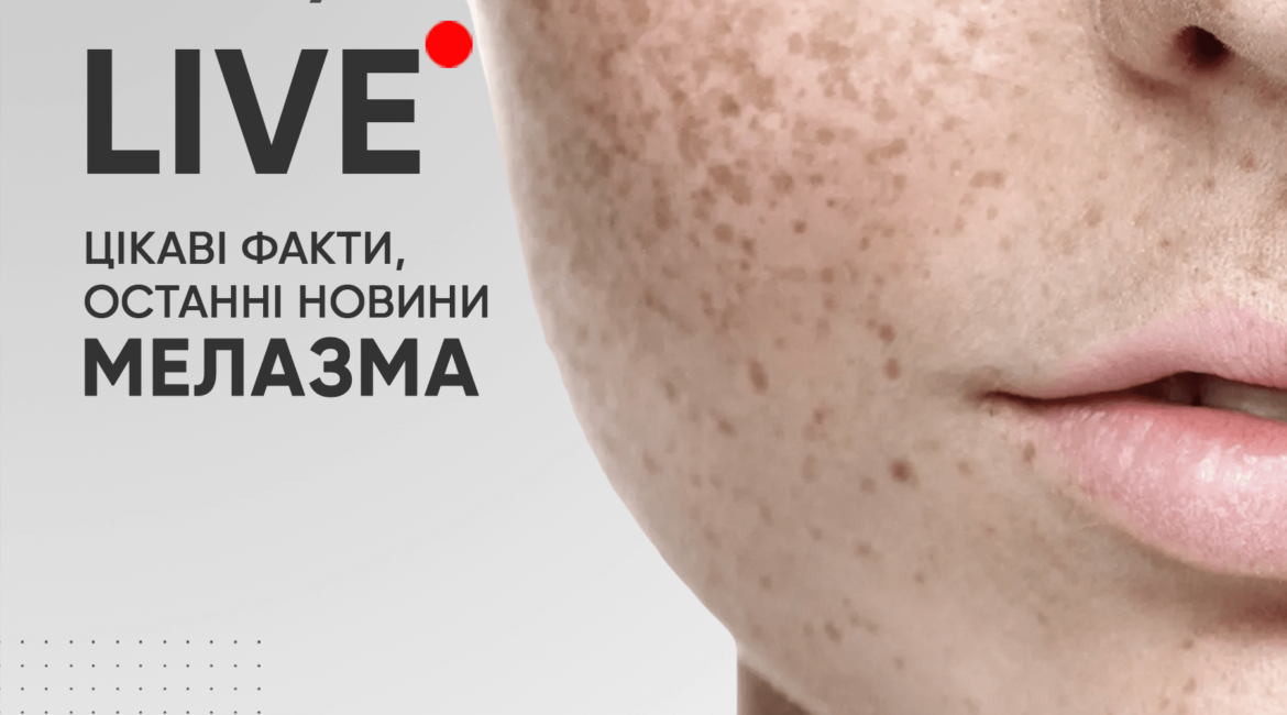 Melazma. Tsikavi fakty, ostanni novyny