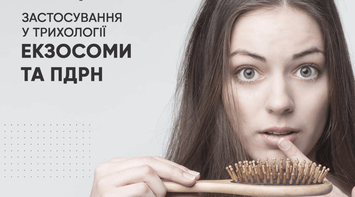 Ekzosomy ta PDRN zastosuvannya u trykholohiyi